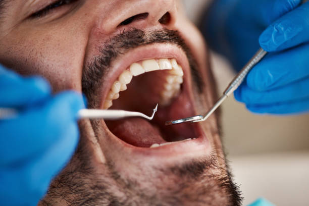 Best Emergency Gum Treatment in Franklin Grove, IL