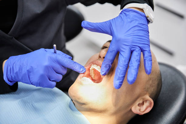 Best Emergency Dental Care for Broken or Chipped Teeth in Franklin Grove, IL